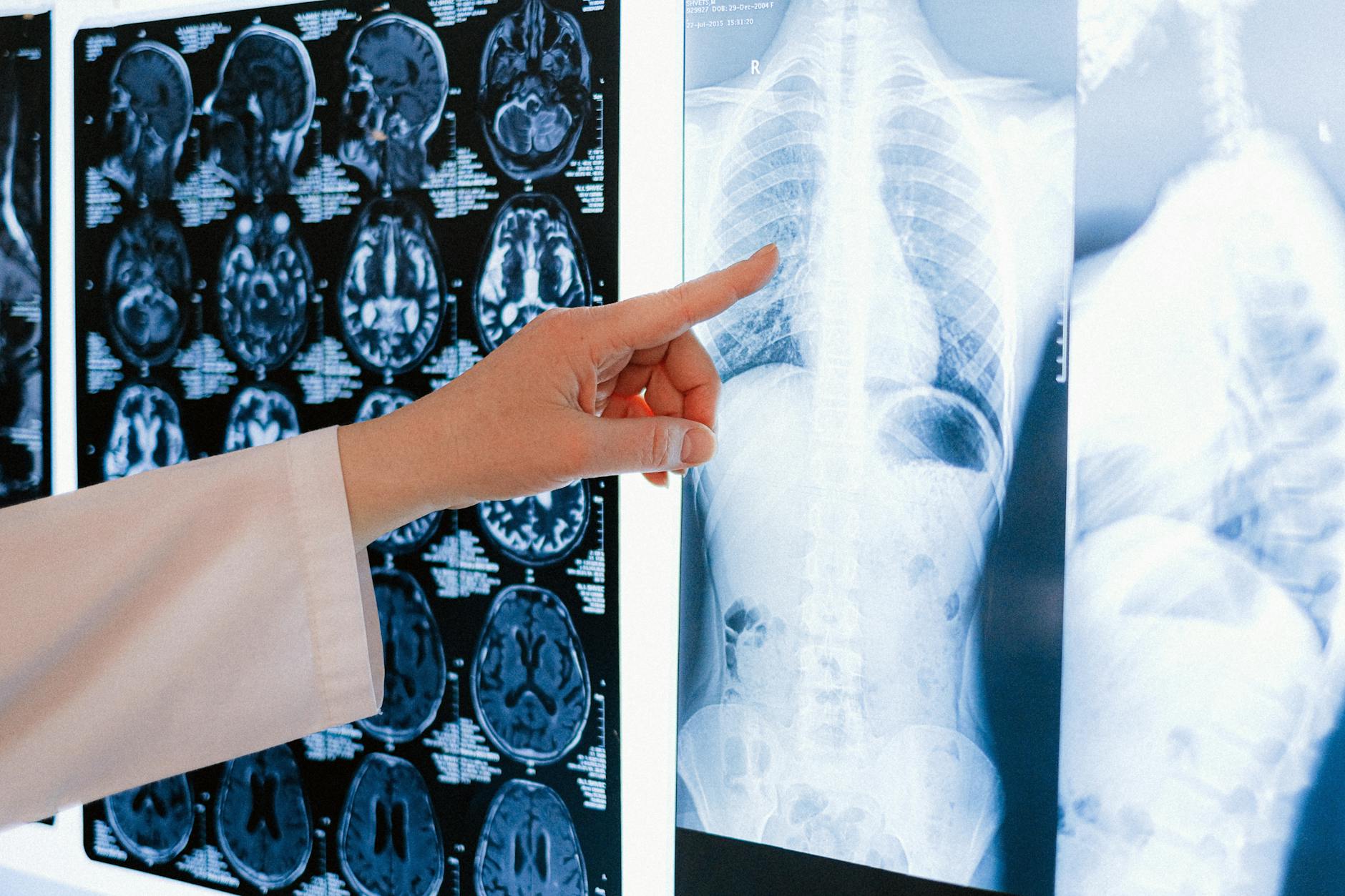 woman pointing at x ray picture